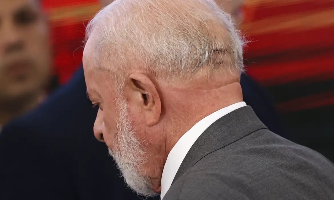 Lula realiza novo procedimento nesta quinta para complementar cirurgia na cabeça