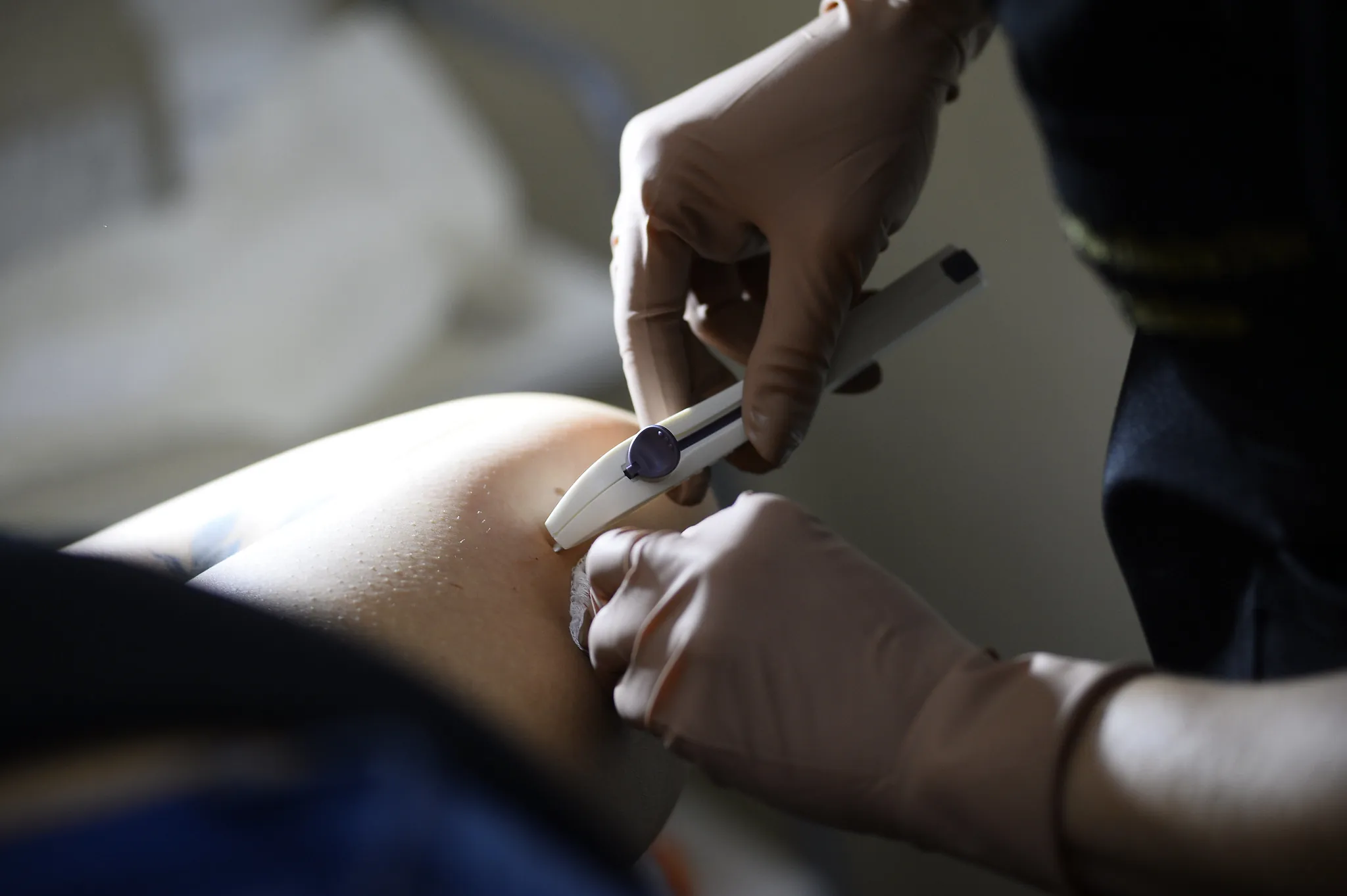 Vereadores aprovam oferta de implantes contraceptivos de graça em Mogi das Cruzes