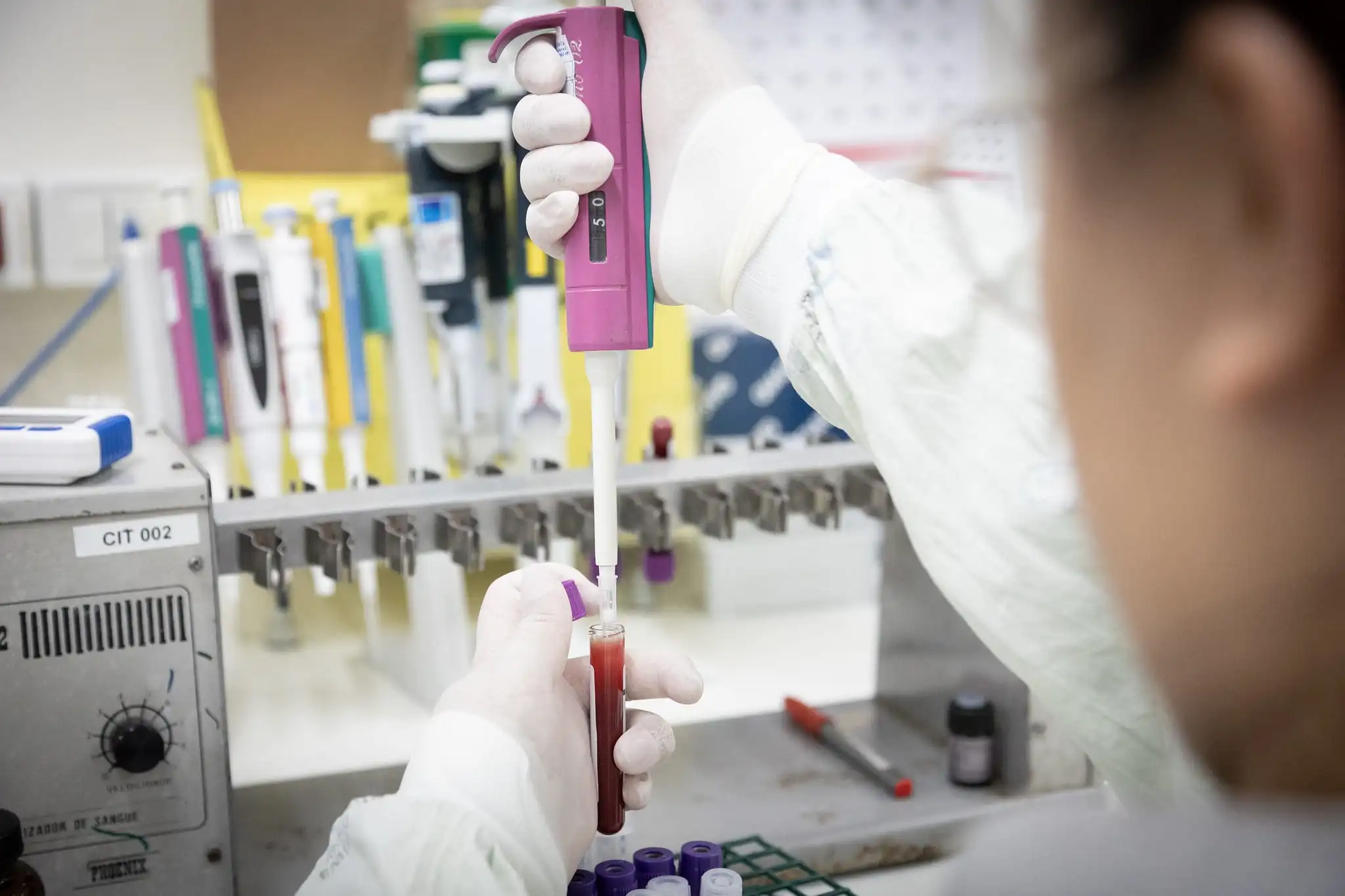 Paciente internado com suspeita de Ebola em SP é diagnosticado com meningite