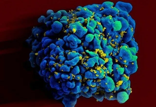 Dois novos casos de remissão do HIV são anunciados em conferência no RJ; total chega a 13